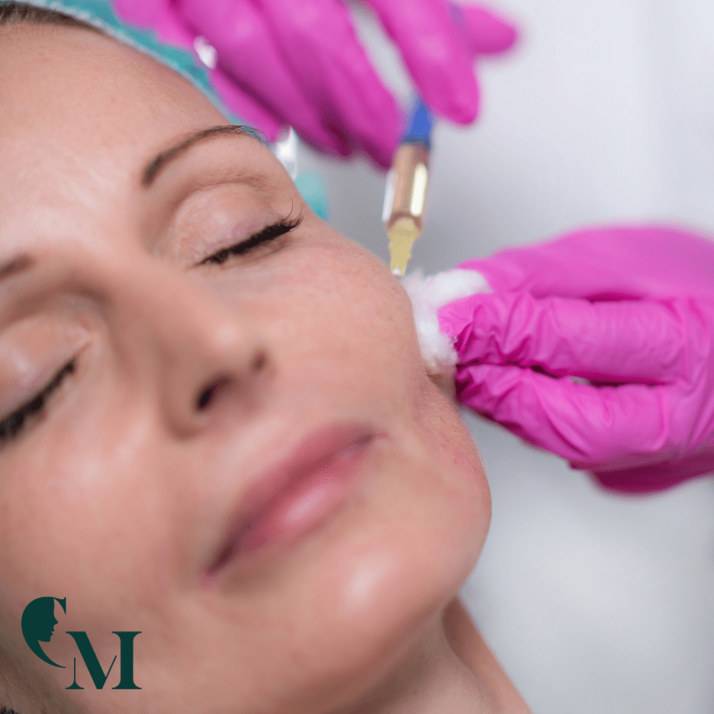 Volumetria facială cu acid hialuronic