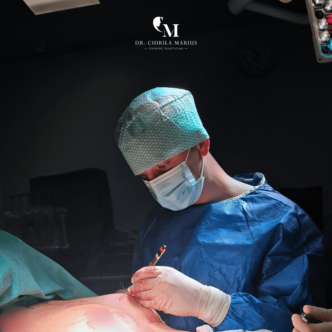 Reintervențiile în chirurgia sânului