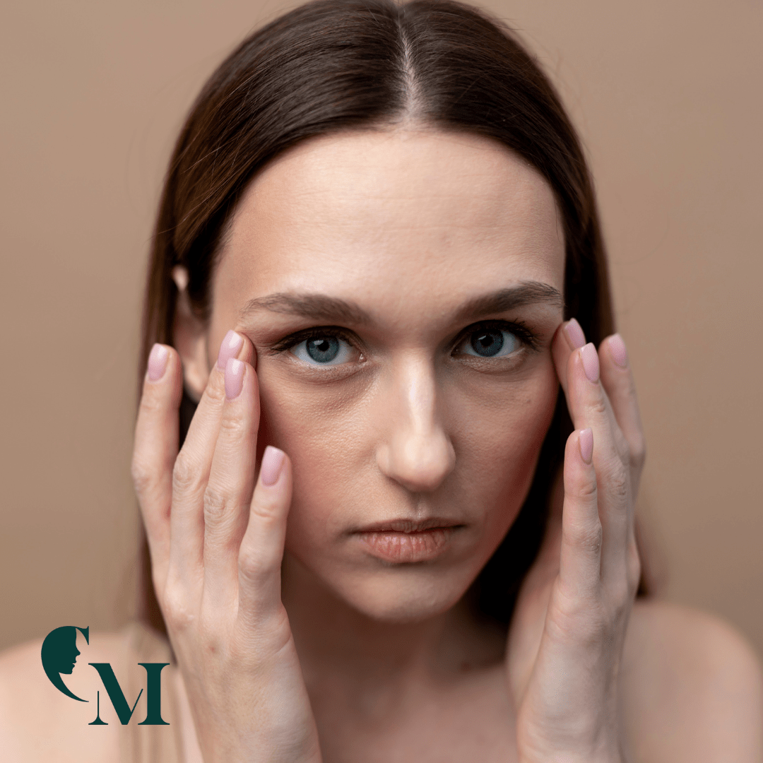 Față „obosită” chiar și după filler